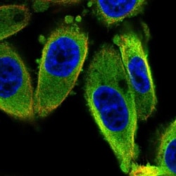 ISCU Antibody, Novus Biologicals 25 &mu;L, Unlabeled:Antibodies, Polyclonal
